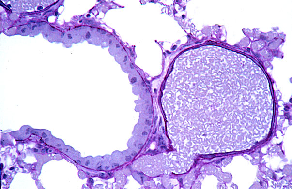  lung (mouse), Clara cells and pulmonary artery 