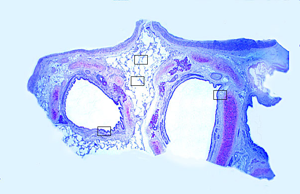  lung (human), intrapulmonary bronchus 