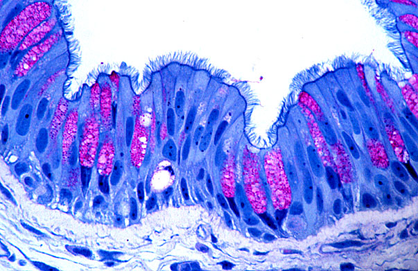  lung (human), respiratory epithelium 