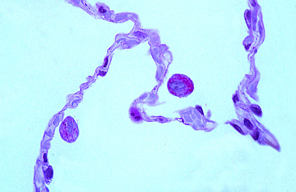  lung (human), type I and II 