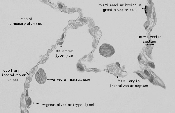  lung (human), type I and II 