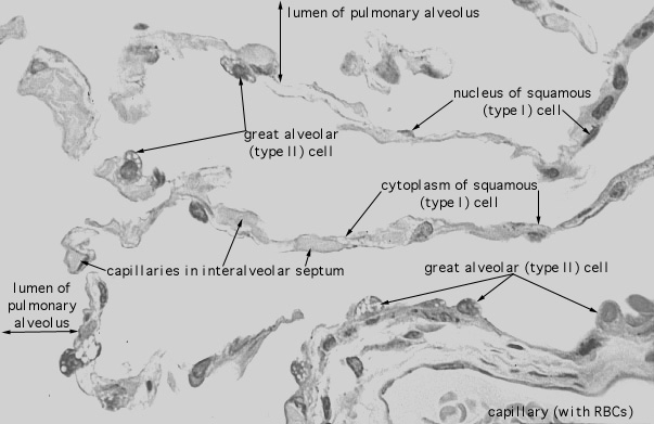  lung (human), alveoli 