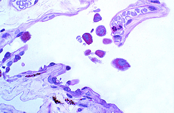  lung (human), alveolar macrophages 