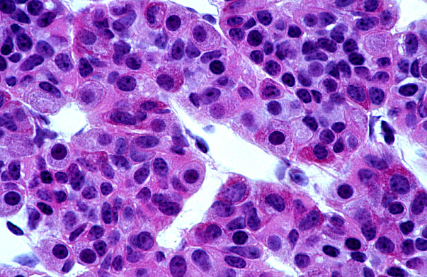  anterior pituitary gland, H&E 