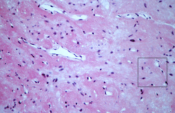  pituitary gland, posterior 