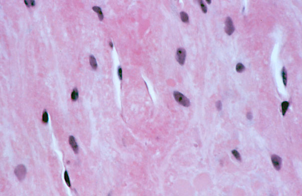  pituitary gland, posterior, pituicytes 
