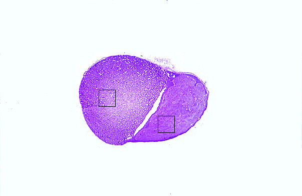  pituitary gland, PAS 