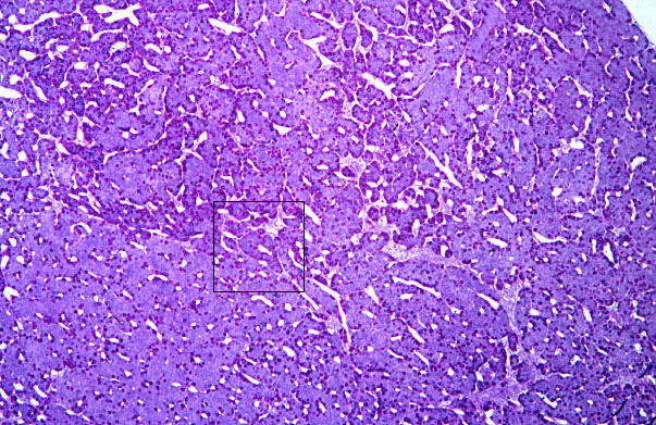  pituitary gland, posterior 