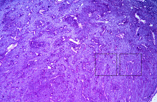  pituitary gland, posterior 