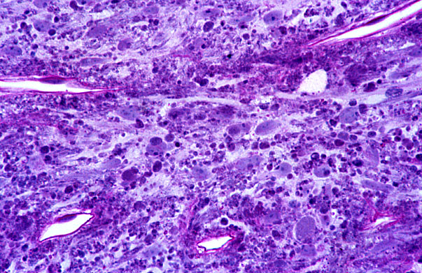  pituitary gland, posterior 