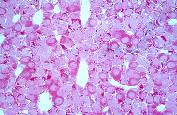  anterior pituitary gland, azocarmine 