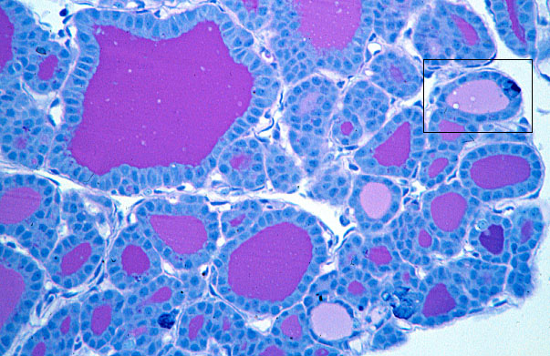  thyroid gland 