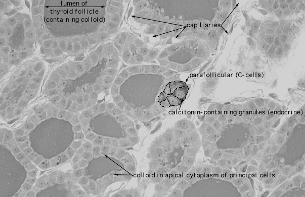  thyroid gland, parafollicular cells 
