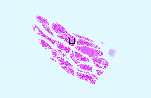  thyroid gland 