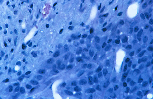  pineal gland, pinealocytes and glial cells 