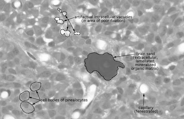  pineal gland, brain sand 