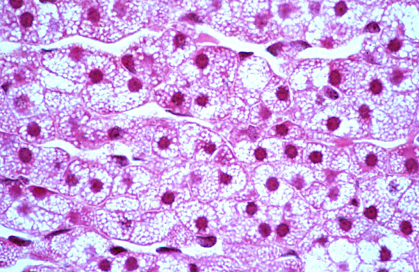  adrenal gland, cortex; zona fasciculata 