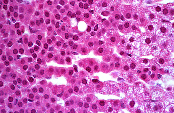  adrenal gland, cortex; zona reticularis 