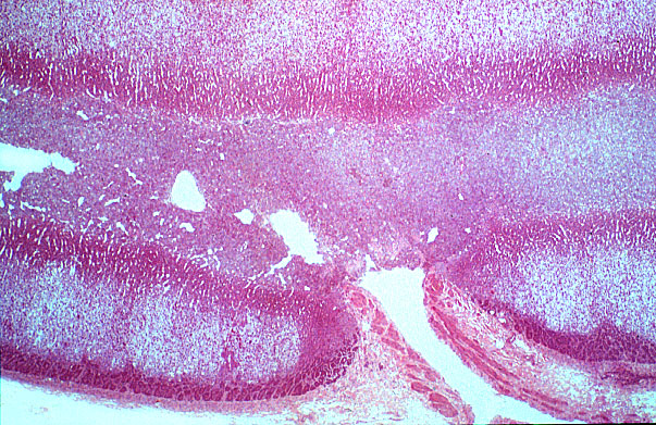  suprarenal vein 