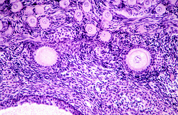  ovary, primary and secondary and primordial follicles 