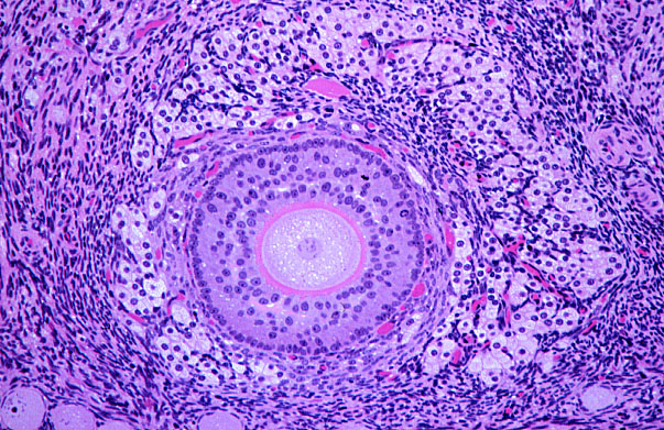  ovary, multilaminar primary follicle 