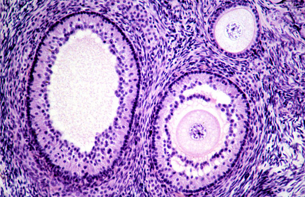  ovary, primary and secondary follicles 