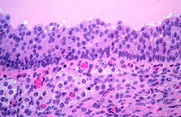  ovary, membrana granulosa 