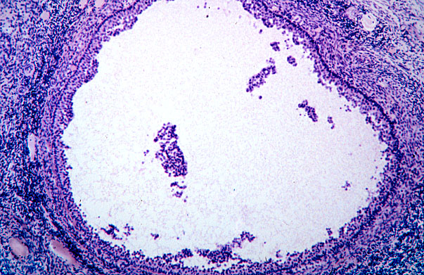  ovary, atretic follicle 