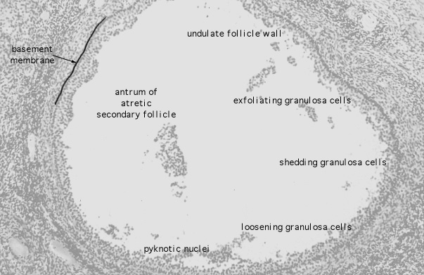  ovary, atretic follicle 