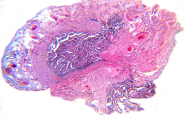  oviduct; infundibulum 