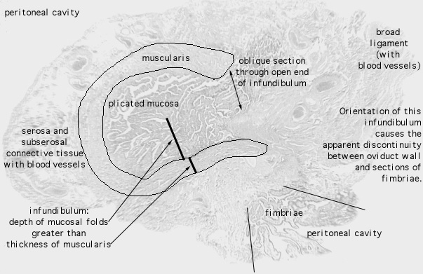  oviduct; infundibulum 