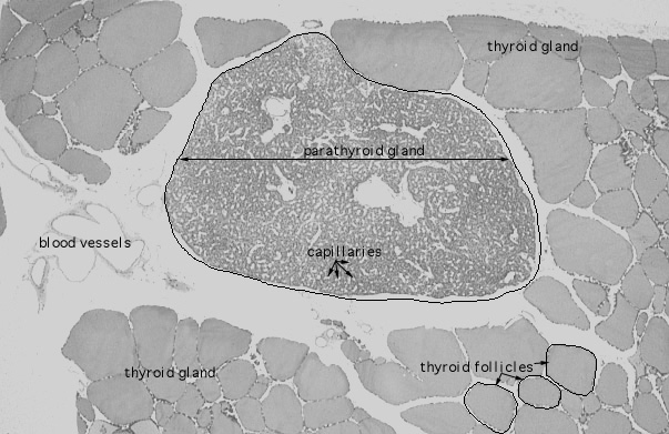  parathyroid gland 