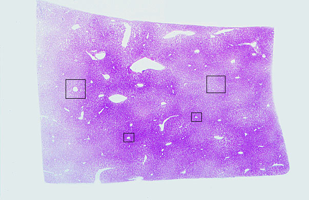  liver, H&E 