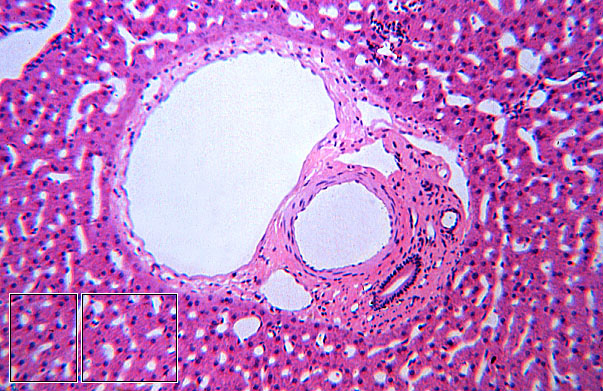  liver; portal triad 
