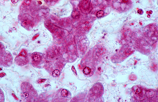  liver, PTAH; bile canaliculus 