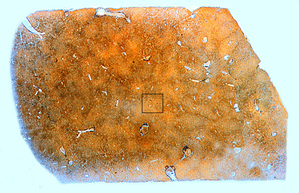  liver, silver 