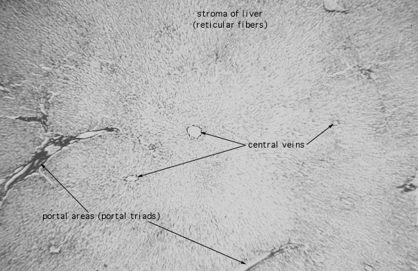  liver, silver 
