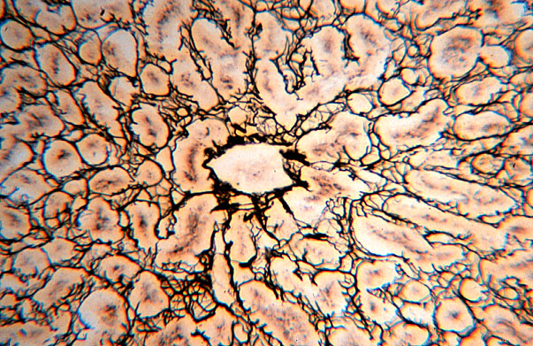  liver, silver 