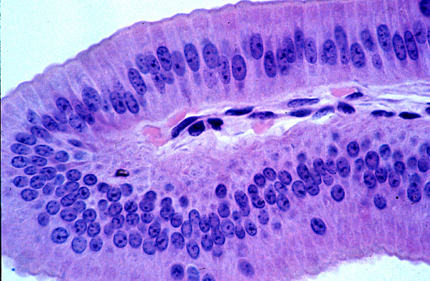  simple columnar epithelium 
