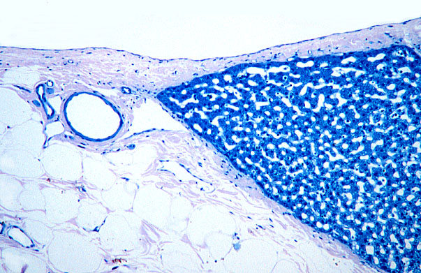  liver, capsule 