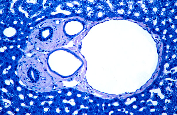  liver, large portal triad 