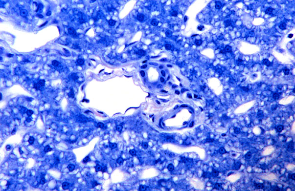  liver, small portal triad 