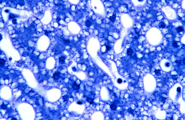  liver, sinusoids and Kupffer cells 