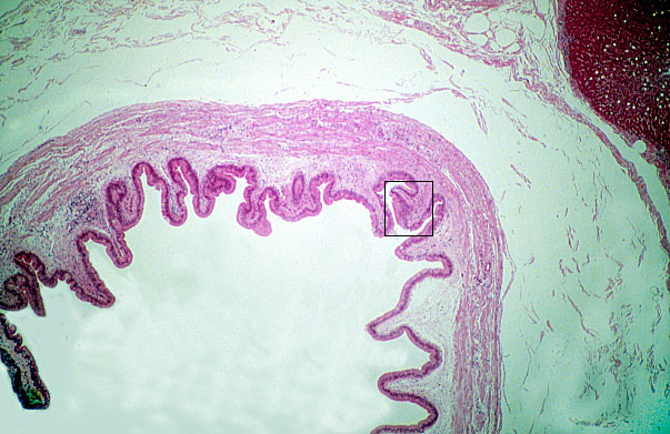 gall bladder 