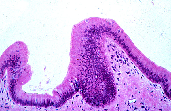  gall bladder 
