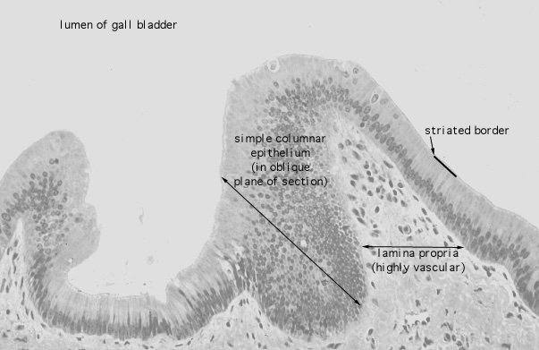  gall bladder 