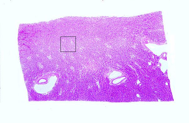  kidney, medulla, vasculature 
