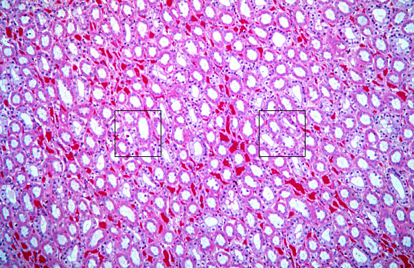 kidney, medulla 