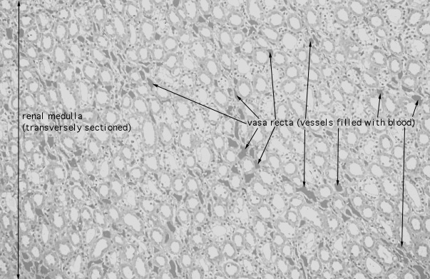  kidney, medulla 