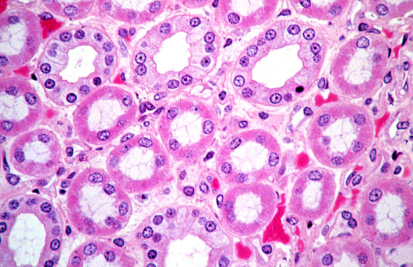  kidney, medulla, collecting duct and ascending tubule 